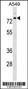 TRIM16 Antibody (N-term)