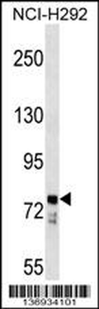 BBS7 Antibody (N-term)