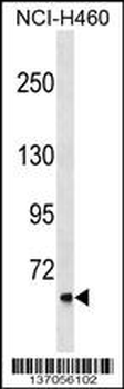 CLCNKA Antibody (N-term)