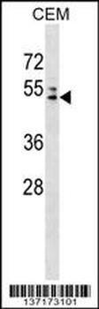 AP4M1 Antibody (Center)