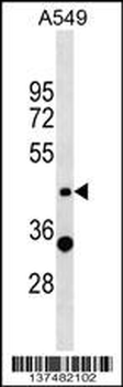 ZNF19 Antibody (N-term)