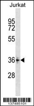ZNF346 Antibody (Center)