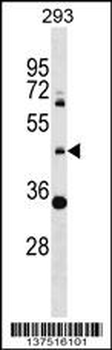 ZNF2 Antibody (N-term)