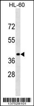 GPR32 Antibody (N-term)