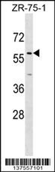 ZNF10 Antibody (N-term)