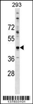 CADM2 Antibody (N-term)