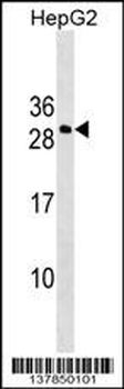 DDIT4L Antibody (N-term)