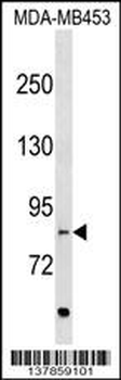 EVI5L Antibody (C-term)