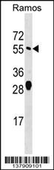 ARFGAP2 Antibody (Center)
