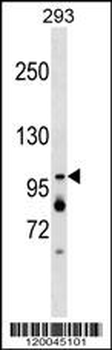 XAB2 Antibody (Center)