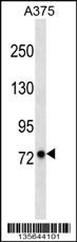 LRFN2 Antibody (C-term)