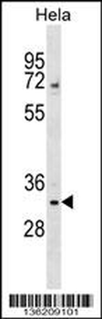 WDR4 Antibody (Center)