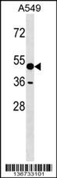 AMY1A Antibody (C-term)