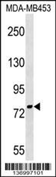 PNPT1 Antibody (Center)