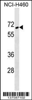 ZNF83 Antibody (N-term)