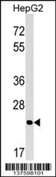 MRTO4 Antibody (N-term)