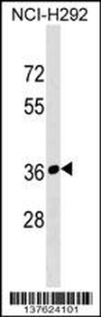 RPIA Antibody (Center)