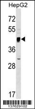 SERINC2 Antibody (Center)