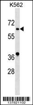 ASB10 Antibody (N-term)