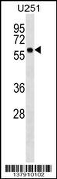 BTN3A3 Antibody (N-term)