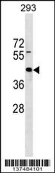 ZNF331 Antibody (N-term)