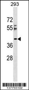 RSRC2 Antibody (N-term)