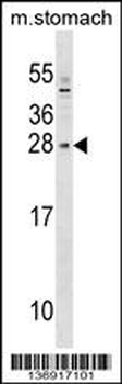 SIX6 Antibody (Center)