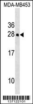 Mouse Hoxc5 Antibody (C-term)