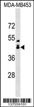 ALX1 Antibody (Center)