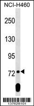 SCML2 Antibody (Center)