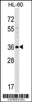 SPOCK3 Antibody (N-term)