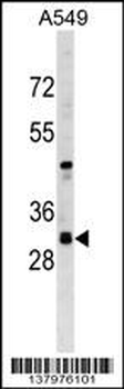 RASSF3 Antibody (N-term)