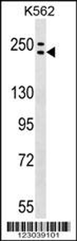 ADCY9 Antibody (C-term)