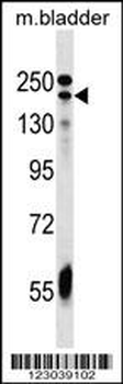 ADCY9 Antibody (C-term)