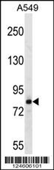 FSCB Antibody (C-term)