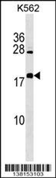 BEX4 Antibody (Center)