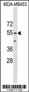 CORO1B Antibody (C-term)