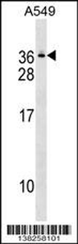 GEMIN8 Antibody (C-term)