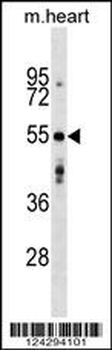 AGPAT9 Antibody (Center)