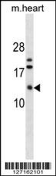 FXYD7 Antibody (N-term)