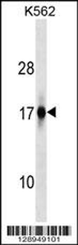 ZFAND2A Antibody (Center)