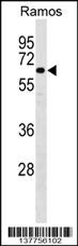 SASS6 Antibody (Center)