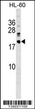 DNAJC30 Antibody (C-term)