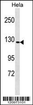 GTF2IRD1 Antibody (N-term)