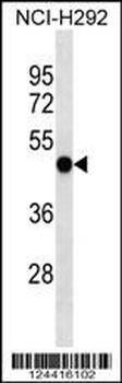 EIF2S3 Antibody (C-term)