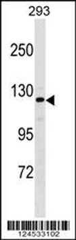 AFF2 Antibody (Center)