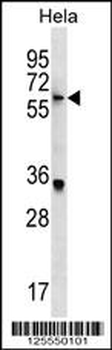 KLH22 Antibody (C-term)