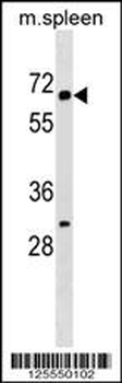 KLH22 Antibody (C-term)