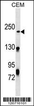 NHSL1 Antibody (Center)