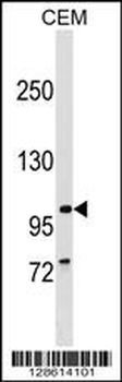 PTHB1 Antibody (C-term)
